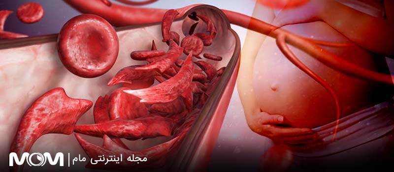 کم خونی فقر آهن در بارداری