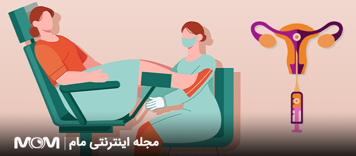 انتقال جنین دو مرحله ای در IVF