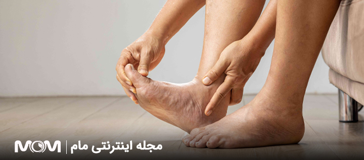 ورم پا بعد از زایمان طبیعی و سزارین