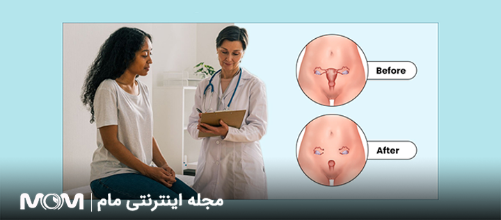 عوارض بعد از عمل برداشتن رحم و تخمدان