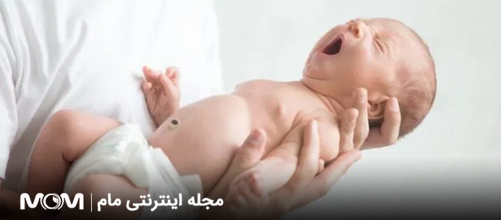 سندرم وست (اسپاسم در نوزادان شیرخوارگان)
