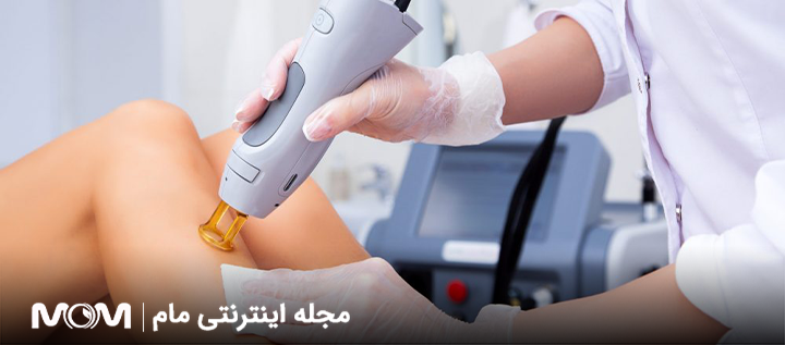 آیا لیزر باعث نازایی میشود؟ 