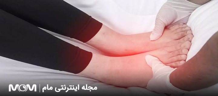 درمان طبیعی برای کاهش تورم پس از زایمان