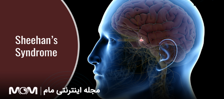 علائم سندرم شیهان