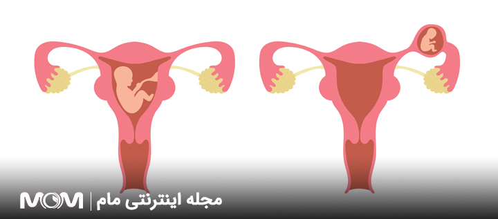 علت پایین بودن بتا