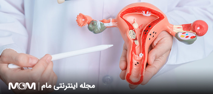 مراقبت های بعد از عمل اندومتریوز