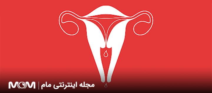 زمان اولین پریود بعد از سقط