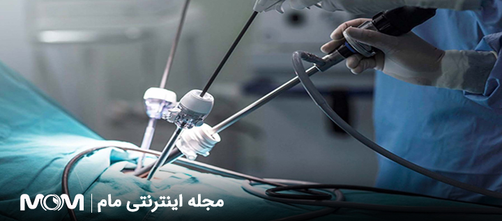 بارداری بعد از لاپاراسکوپی