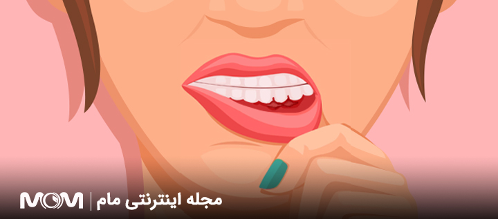 خونریزی لثه در بارداری