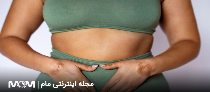 اقدامات قبل از میومکتومی