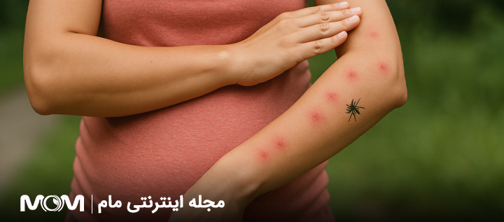 نیش حشرات در بارداری