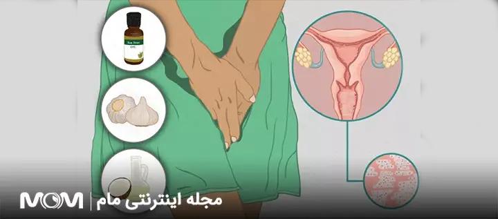 درمان عفونت واژن در خانه